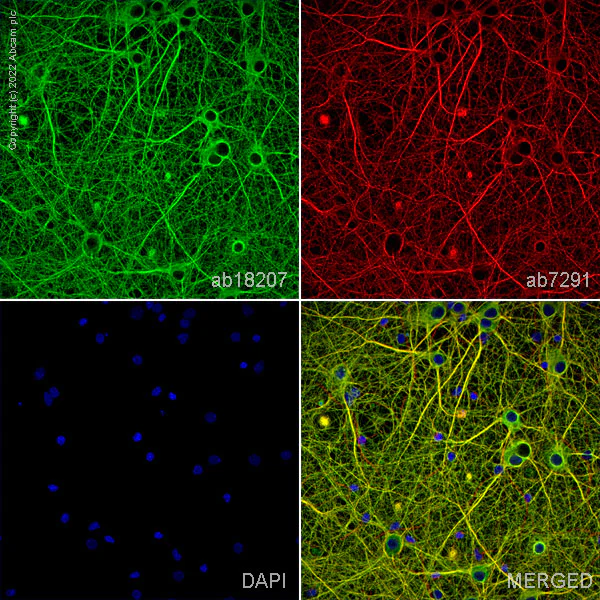 Immunocytochemistry/ Immunofluorescence - Anti-beta III Tubulin antibody - Neuronal Marker (AB18207)