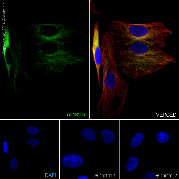 Immunocytochemistry/ Immunofluorescence - Anti-beta III Tubulin antibody - Neuronal Marker (AB18207)