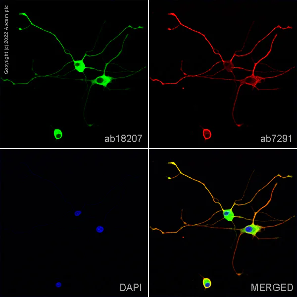 Immunocytochemistry/ Immunofluorescence - Anti-beta III Tubulin antibody - Neuronal Marker (AB18207)