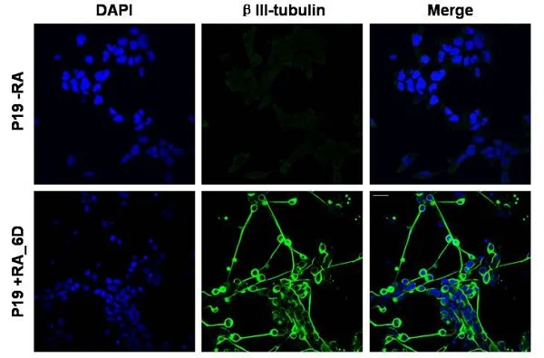 Immunocytochemistry/ Immunofluorescence - Anti-beta III Tubulin antibody - Neuronal Marker (AB18207)