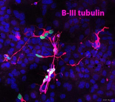 Immunocytochemistry/ Immunofluorescence - Anti-beta III Tubulin antibody - Neuronal Marker (ab18207), expandable thumbnail