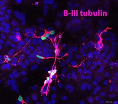 Immunocytochemistry/ Immunofluorescence - Anti-beta III Tubulin antibody - Neuronal Marker (AB18207)