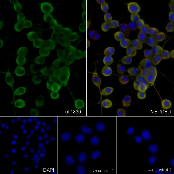 Immunocytochemistry/ Immunofluorescence - Anti-beta III Tubulin antibody - Neuronal Marker (AB18207)