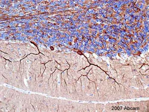 Immunohistochemistry (Formalin/PFA-fixed paraffin-embedded sections) - Anti-beta III Tubulin antibody - Neuronal Marker (AB18207)