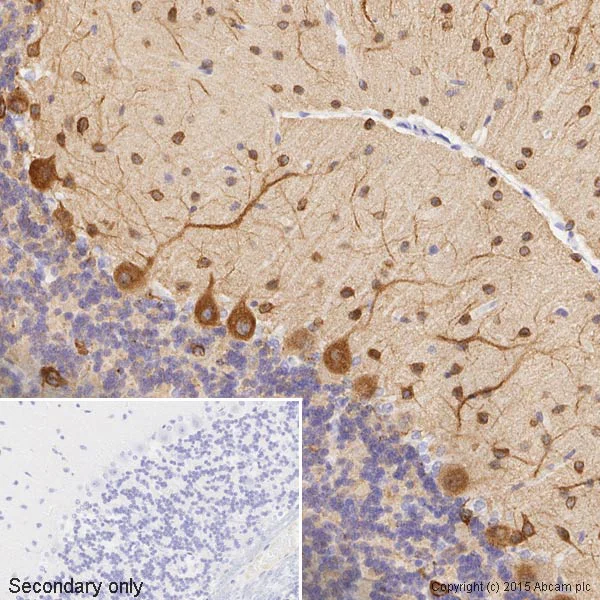 Immunohistochemistry (Formalin/PFA-fixed paraffin-embedded sections) - Anti-beta III Tubulin antibody - Neuronal Marker (AB18207)