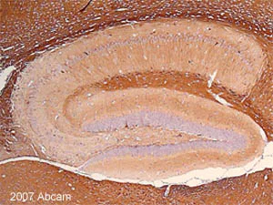Immunohistochemistry (Formalin/PFA-fixed paraffin-embedded sections) - Anti-beta III Tubulin antibody - Neuronal Marker (AB18207)