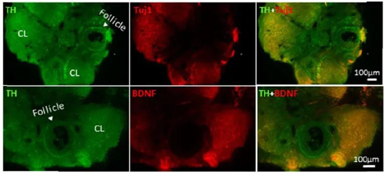 Immunohistochemistry (Formalin/PFA-fixed paraffin-embedded sections) - Anti-beta III Tubulin antibody - Neuronal Marker (AB18207)