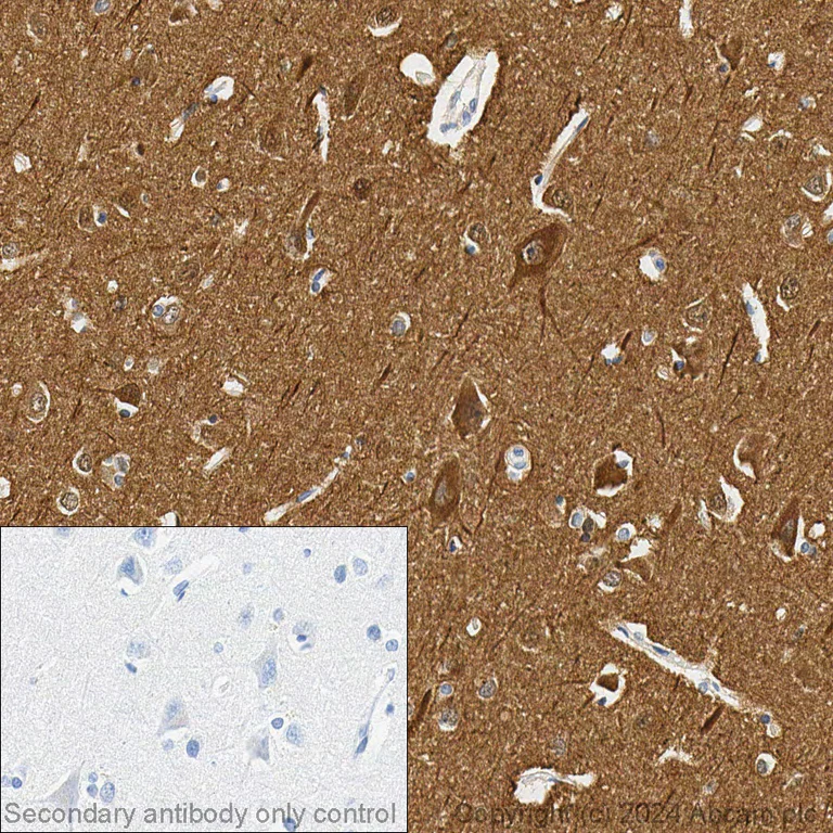 Immunohistochemistry (Formalin/PFA-fixed paraffin-embedded sections) - Anti-beta III Tubulin antibody - Neuronal Marker (AB18207)