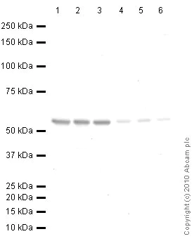 Western blot - Anti-beta III Tubulin antibody - Neuronal Marker (AB18207)