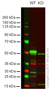 Western blot - Anti-beta III Tubulin antibody - Neuronal Marker (AB18207)