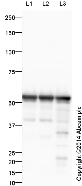 Western blot - Anti-beta III Tubulin antibody - Neuronal Marker (AB18207)