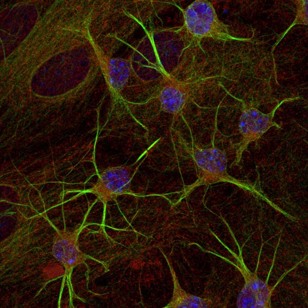 Immunocytochemistry/ Immunofluorescence - Anti-beta III Tubulin antibody (AB41489), expandable thumbnail