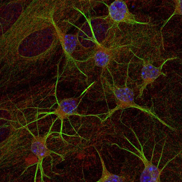 Immunocytochemistry/ Immunofluorescence - Anti-beta III Tubulin antibody - Neuronal Marker (AB41489)