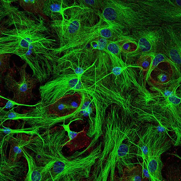 Immunocytochemistry/ Immunofluorescence - Anti-beta III Tubulin antibody (AB41489), expandable thumbnail