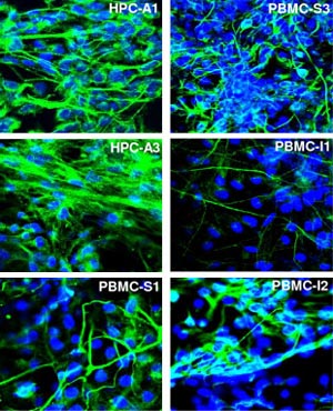 Immunocytochemistry/ Immunofluorescence - Anti-beta III Tubulin antibody (AB41489), expandable thumbnail