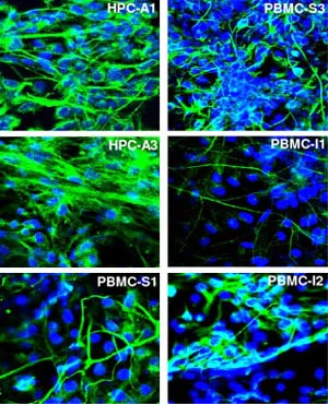 Immunocytochemistry/ Immunofluorescence - Anti-beta III Tubulin antibody - Neuronal Marker (AB41489)