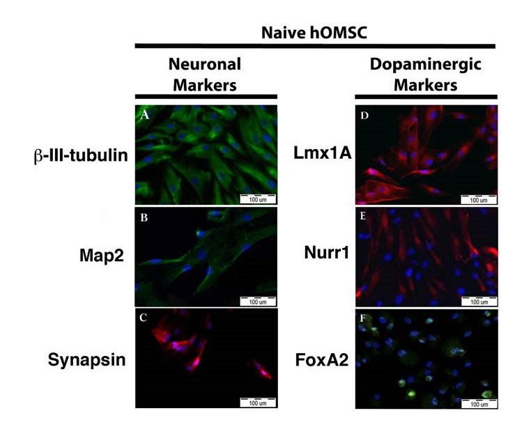 Immunocytochemistry - Anti-beta III Tubulin antibody [TU-20] - Neuronal Marker (AB7751), expandable thumbnail