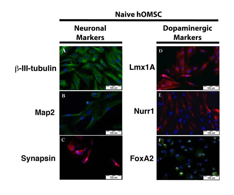 Immunocytochemistry - Anti-beta III Tubulin antibody [TU-20] - Neuronal Marker (AB7751)