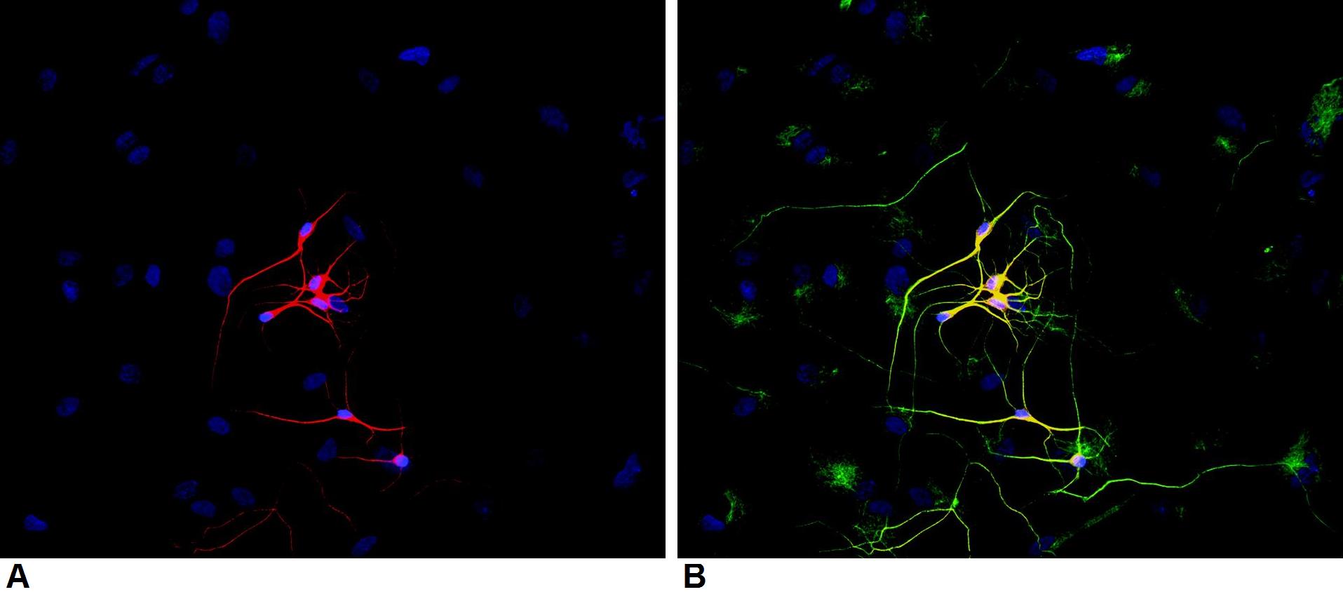 Immunocytochemistry/ Immunofluorescence - Anti-beta III Tubulin antibody [TU-20] - Neuronal Marker (AB7751), expandable thumbnail