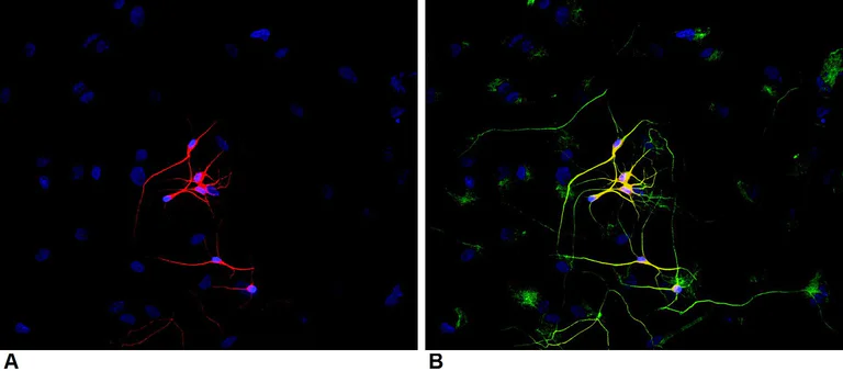 Immunocytochemistry/ Immunofluorescence - Anti-beta III Tubulin antibody [TU-20] - Neuronal Marker (AB7751)