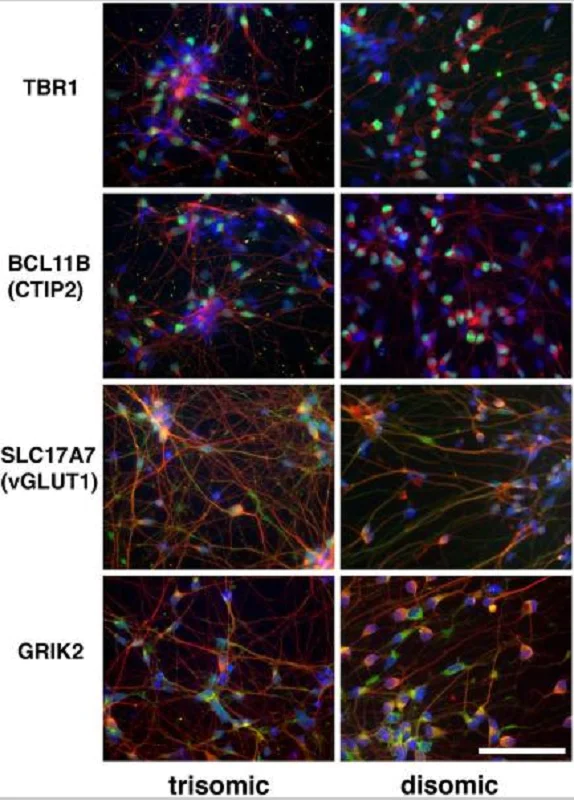 Immunocytochemistry/ Immunofluorescence - Anti-beta III Tubulin antibody [TU-20] - Neuronal Marker (AB7751)
