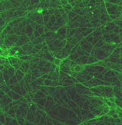 Immunocytochemistry/ Immunofluorescence - Anti-beta III Tubulin antibody [TU-20] - Neuronal Marker (ab7751), expandable thumbnail
