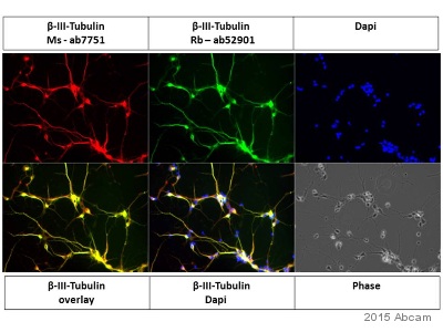 Immunocytochemistry/ Immunofluorescence - Anti-beta III Tubulin antibody [TU-20] - Neuronal Marker (ab7751), expandable thumbnail