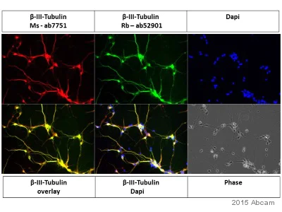 Immunocytochemistry/ Immunofluorescence - Anti-beta III Tubulin antibody [TU-20] - Neuronal Marker (AB7751)
