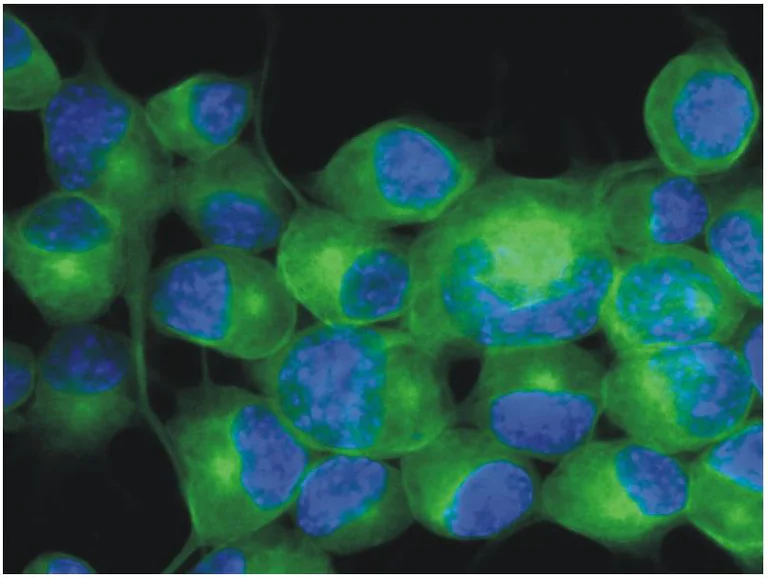 Immunocytochemistry/ Immunofluorescence - Anti-beta III Tubulin antibody [TU-20] - Neuronal Marker (AB7751)