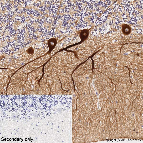Immunohistochemistry (Formalin/PFA-fixed paraffin-embedded sections) - Anti-beta III Tubulin antibody [TU-20] - Neuronal Marker (ab7751), expandable thumbnail