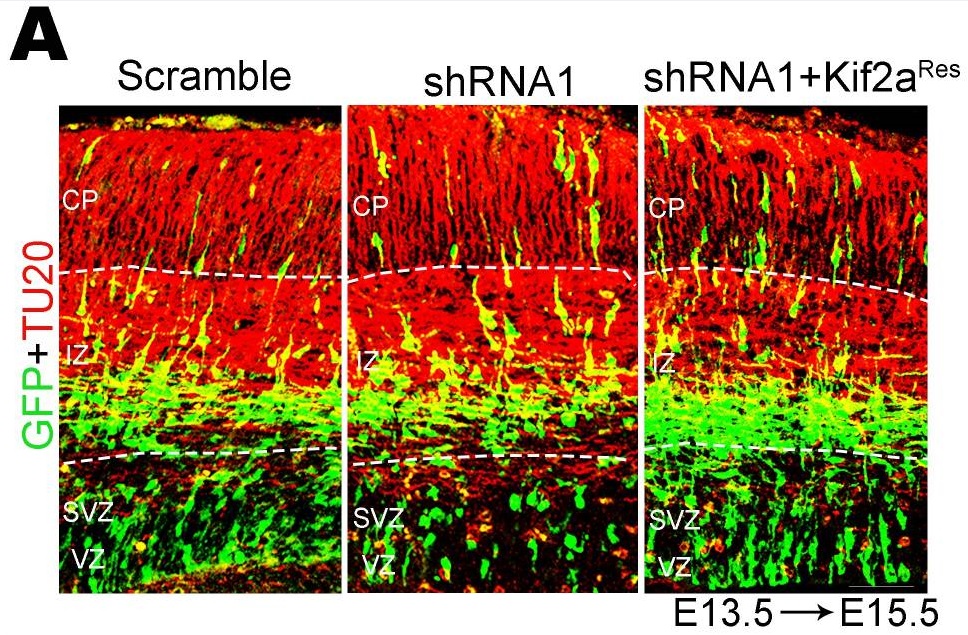 Immunohistochemistry (Formalin/PFA-fixed paraffin-embedded sections) - Anti-beta III Tubulin antibody [TU-20] - Neuronal Marker (AB7751), expandable thumbnail