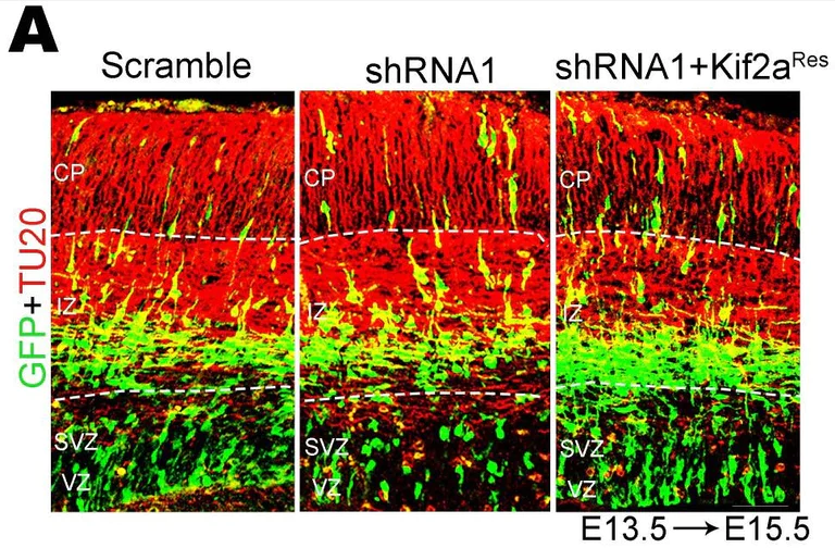 Immunohistochemistry (Formalin/PFA-fixed paraffin-embedded sections) - Anti-beta III Tubulin antibody [TU-20] - Neuronal Marker (AB7751)