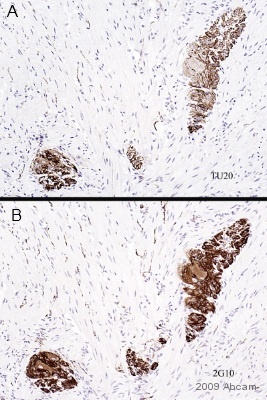 Immunohistochemistry (Formalin/PFA-fixed paraffin-embedded sections) - Anti-beta III Tubulin antibody [TU-20] - Neuronal Marker (ab7751), expandable thumbnail