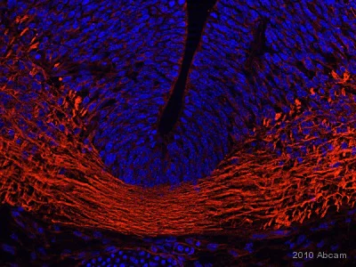 Immunohistochemistry (Formalin/PFA-fixed paraffin-embedded sections) - Anti-beta III Tubulin antibody [TU-20] - Neuronal Marker (AB7751)