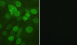 Immunocytochemistry/ Immunofluorescence - Anti-beta III Tubulin (phospho S172) antibody (AB76286), expandable thumbnail