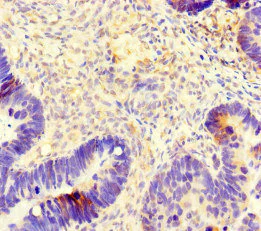 Immunohistochemistry (Formalin/PFA-fixed paraffin-embedded sections) - Anti-beta IV Tubulin antibody (AB222822)