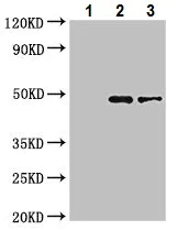 Immunoprecipitation - Anti-beta IV Tubulin antibody (AB222822)