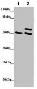 Western blot - Anti-beta IV Tubulin antibody (AB222822)