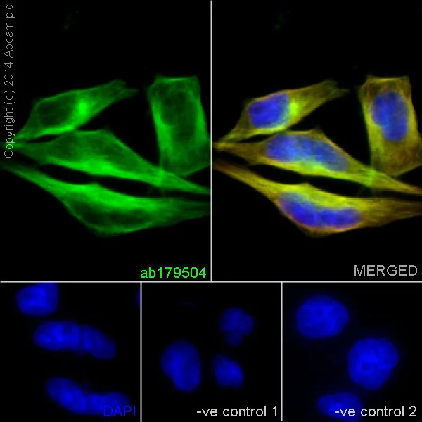 Immunocytochemistry/ Immunofluorescence - Anti-beta IV Tubulin antibody [EPR16775] - BSA and Azide free (AB250103)