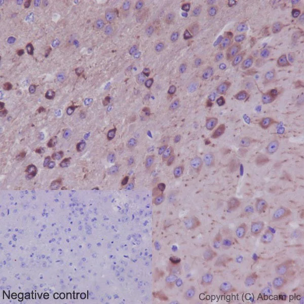 Immunohistochemistry (Formalin/PFA-fixed paraffin-embedded sections) - Anti-beta IV Tubulin antibody [EPR16775] - BSA and Azide free (AB250103)