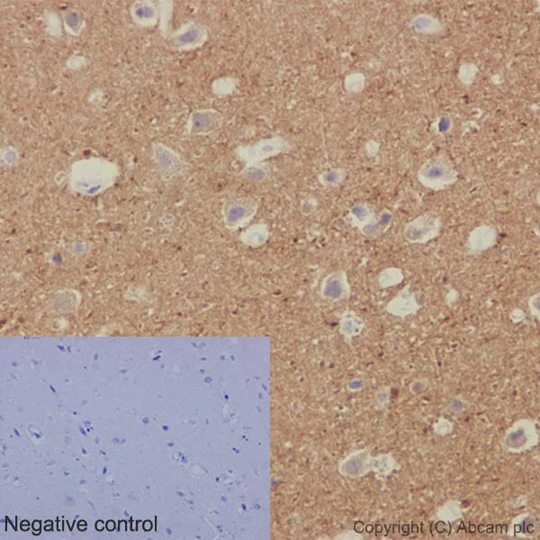 Immunohistochemistry (Formalin/PFA-fixed paraffin-embedded sections) - Anti-beta IV Tubulin antibody [EPR16775] - BSA and Azide free (AB250103)