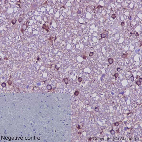 Immunohistochemistry (Formalin/PFA-fixed paraffin-embedded sections) - Anti-beta IV Tubulin antibody [EPR16775] - BSA and Azide free (AB250103)