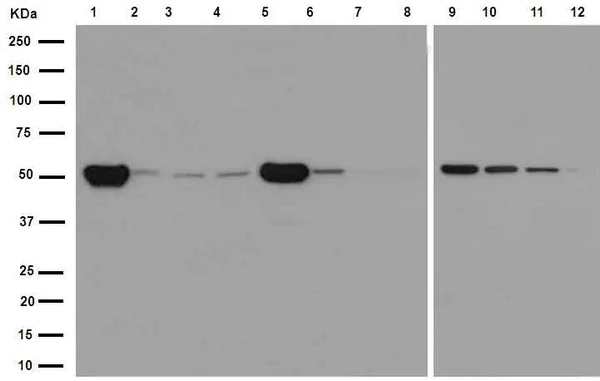 Western blot - Anti-beta IV Tubulin antibody [EPR16775] - BSA and Azide free (AB250103)