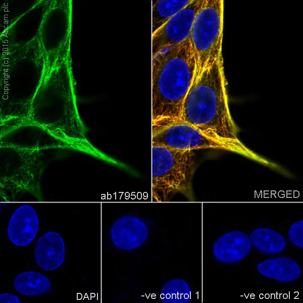 Immunocytochemistry/ Immunofluorescence - Anti-beta IV Tubulin antibody [EPR16776] - BSA and Azide free (AB238433)