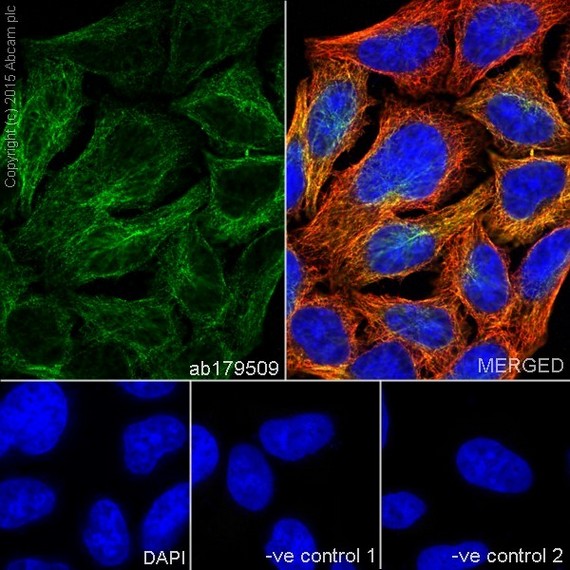 Immunocytochemistry/ Immunofluorescence - Anti-beta IV Tubulin antibody [EPR16776] - BSA and Azide free (AB238433)