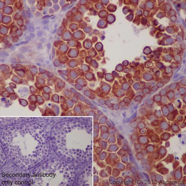 Immunohistochemistry (Formalin/PFA-fixed paraffin-embedded sections) - Anti-beta IV Tubulin antibody [EPR16776] - BSA and Azide free (AB238433)