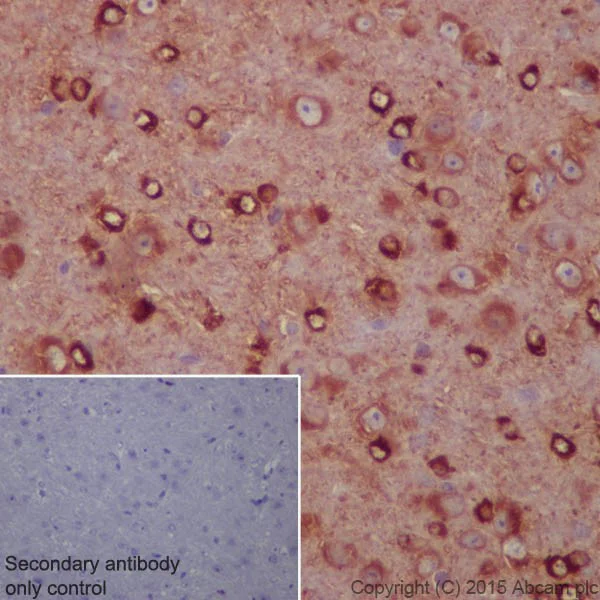 Immunohistochemistry (Formalin/PFA-fixed paraffin-embedded sections) - Anti-beta IV Tubulin antibody [EPR16776] - BSA and Azide free (AB238433)