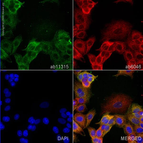 Immunocytochemistry - Anti-beta IV Tubulin antibody [ONS.1A6] (AB11315)