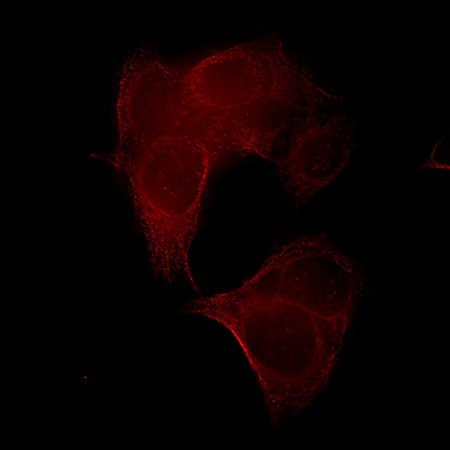 Immunocytochemistry - Anti-beta IV Tubulin antibody [ONS.1A6] (AB11315)