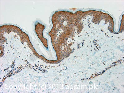 Immunohistochemistry (Formalin/PFA-fixed paraffin-embedded sections) - Anti-beta IV Tubulin antibody [ONS.1A6] (AB11315)